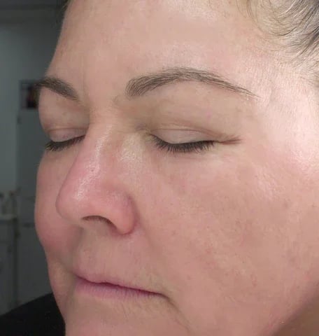 PROMOCION 50% - 🔥Botox Serum BOUDHA-SHOP🔥